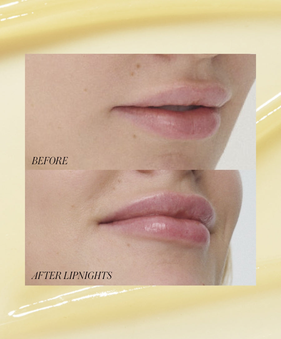 Close-up comparison of lips before and after using Lipnights Overnight Lip Mask, showing improved hydration and smoothness on the lips.